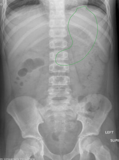 <p>What anatomy is outlined in this image?</p>