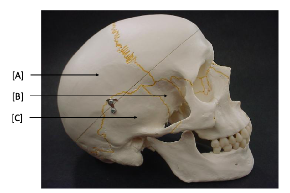 <p>B “Bone”</p>