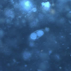 <p>UV</p>