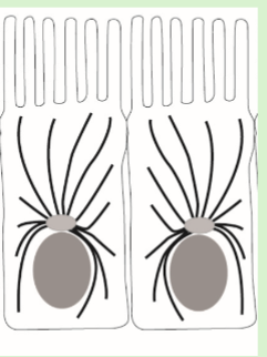 <p>Identify the cytoskeletal structures (black lines) depicted in the epithelial cells shown</p><p>A. microfilaments</p><p>B. microtubules</p><p>C. intermediate filaments</p><p>D. nanotubes</p>