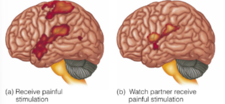 <p>explain the experiment by <strong><u>Singer </u></strong>et al.</p>