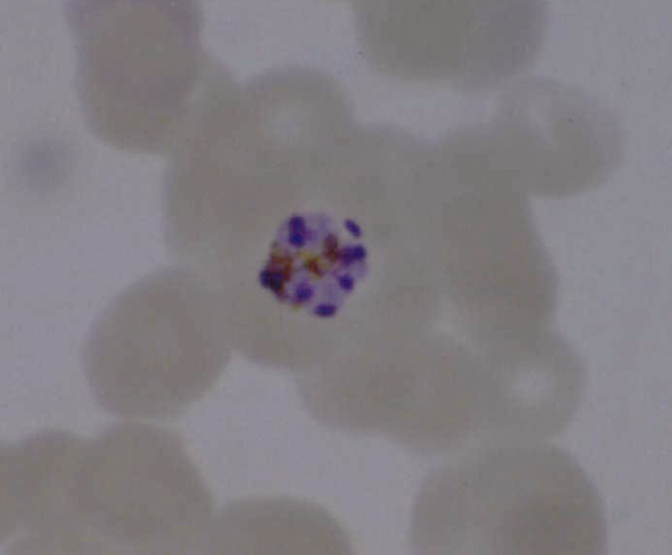 <p>What parasite is this?</p>