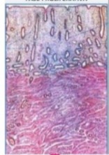 <p>Según la apariencia de las glándulas endometriales en la foto, en que fase del ciclo menstrual esta y que hormona predomina:</p>