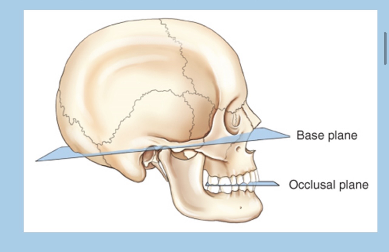 <p>formed by the biting surfaces of the upper and lower teeth with jaws closed</p>