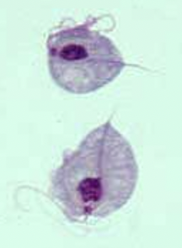 <p>single celled and flagellated excavants that are endosymbionts with a unique fibrous connection between the Golgi apparatus and flagella </p><ul><li><p><em>Trichomoniasis</em> is caused by <em>Trichomonas vaginalis, </em>which causes vaginitis in women</p></li></ul><p></p>