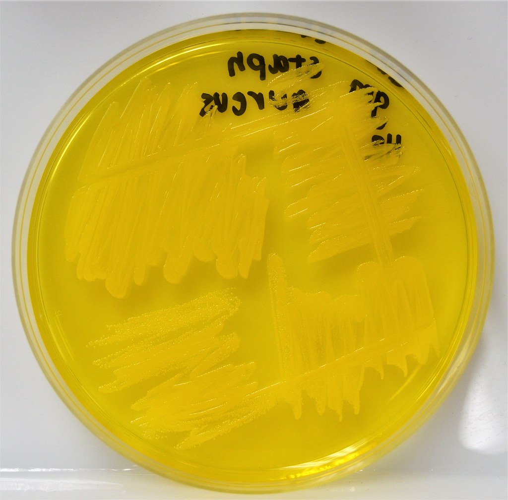 <p><span>The image above shows growth of an organism on MSA agar.&nbsp; The yellow color indicates.&nbsp;</span></p>