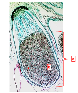 <p>This is a liverwort _______ and it belong to phylum ________.</p>