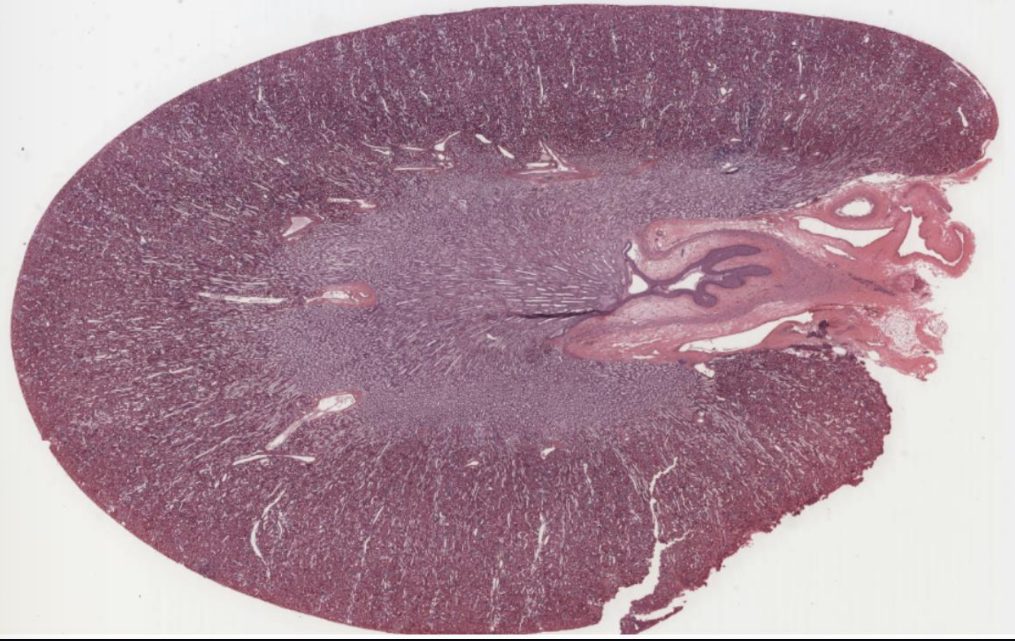 <p>What organ is shown in the picture?</p>