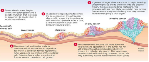 <p>Genetic changes allow the tumor to invade underlying tissue (<span style="color: red;">invasive carcinoma</span>), and shed cells into the blood or lymph to establish new tumors throughout the body (metastatic carcinoma).</p><p></p>