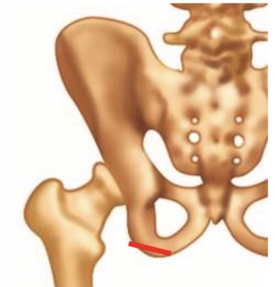 <p><span>Ischial tuberosity 1</span></p>
