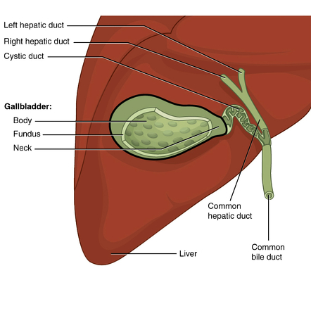 <ul><li><p>gallstones (pigment or cholesterol), typically confirmed w/<strong> US</strong></p></li><li><p>cyst duct obstructed →<strong> cholecystitis </strong></p><ul><li><p><strong>inc. serum bilirubin</strong> if common bile duct blocked</p></li></ul></li><li><p>female, >40, obesity, high cholesterol</p></li></ul><p></p>
