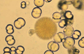 <ul><li><p>round with lines radiating from center or large granular masses or dumbbell shaped</p></li><li><p>Common in rabbits and horses</p></li></ul><p></p>