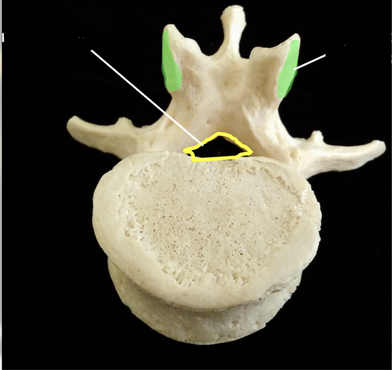 <p>what bone is the highlighted lime green area ? </p>
