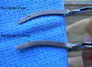 <p><span style="background-color: transparent;">Rochester Pean Vs. Rochester Carmalt</span></p>