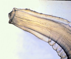 <p>“false lips”bilateral lips around the mouth of the nematodes; they develop from the inner wall of the buccal cavity (found in those species that lost their “true lips”</p>