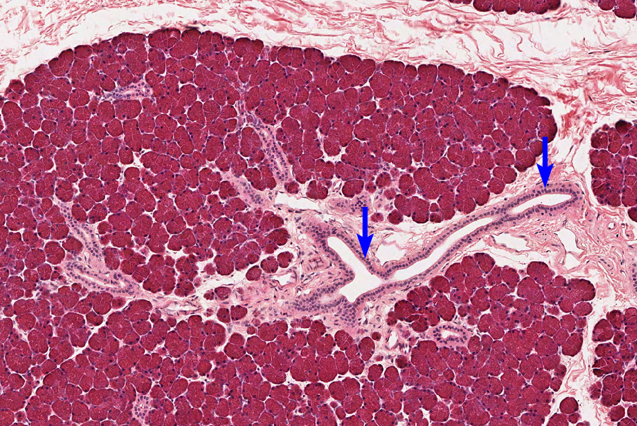 <p>Salivary Gland </p><p><strong>NOTICE: THE OPEN SPACES WHICH IS THE DUCTS THAT THE SECRETIONS ARE RELEASED THROUGH</strong></p>