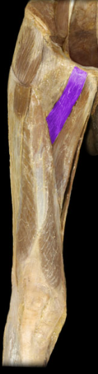 <p>hip adduction, internal rotation, flexion</p>