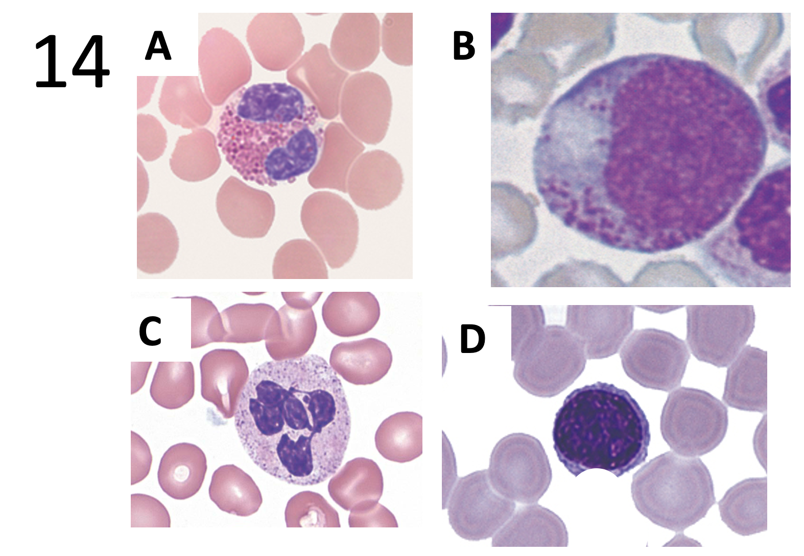 <p><span>Choose from the pictures: which leukocyte is the precursors of tissue macrophages?&nbsp;​</span></p>
