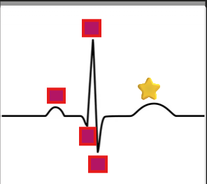 <p>What does the T wave represent? </p>