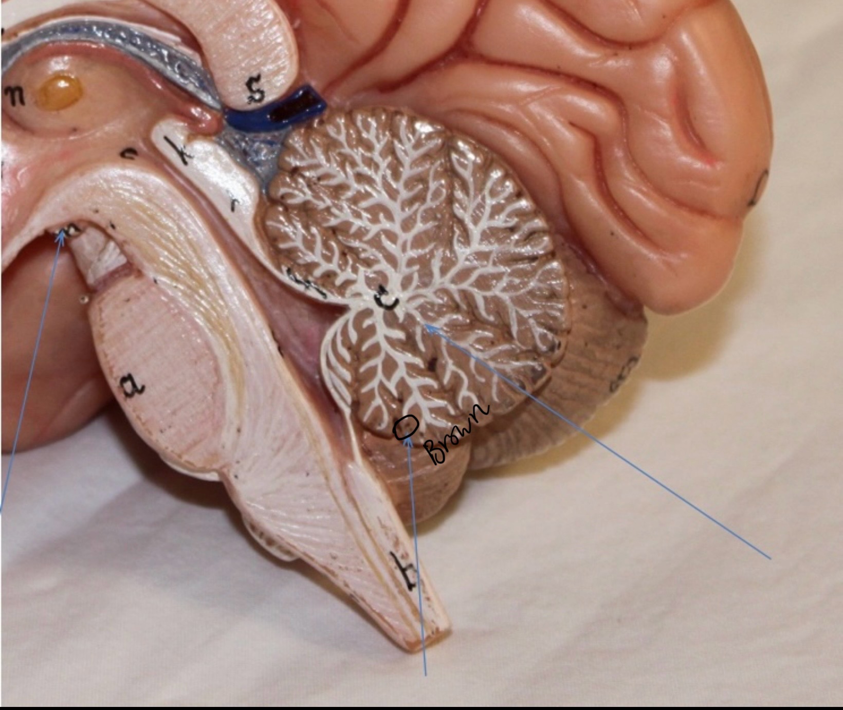 <p>Identify the circled area?</p>