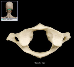 <p>(atlas )The first cervical vertebra; has no vertebral body and no spinous process. </p><p>Ring-shaped, with lateral masses that articulate with the occipital condyles of the skull (allows "yes" nodding motion).</p>