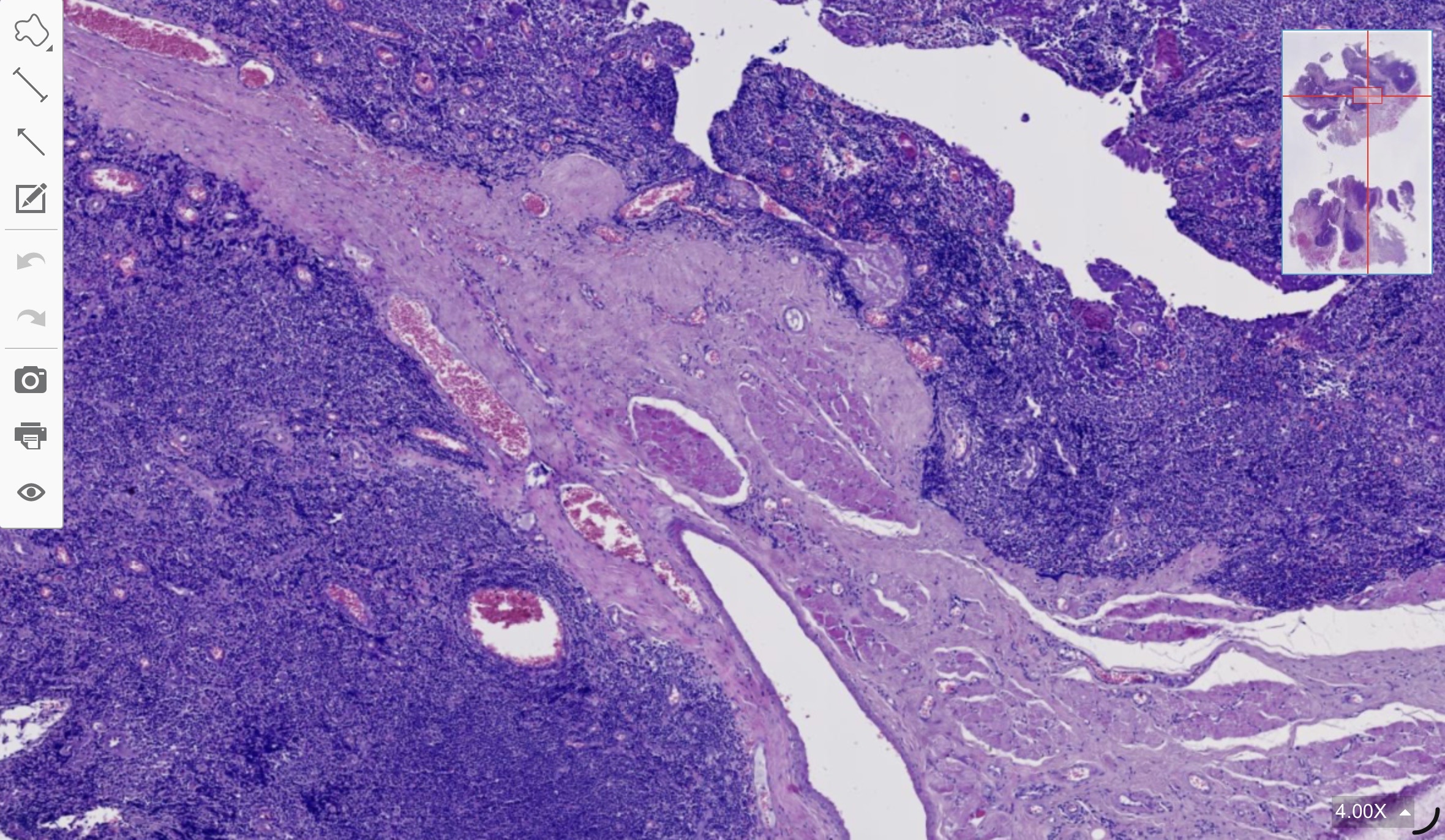 term image