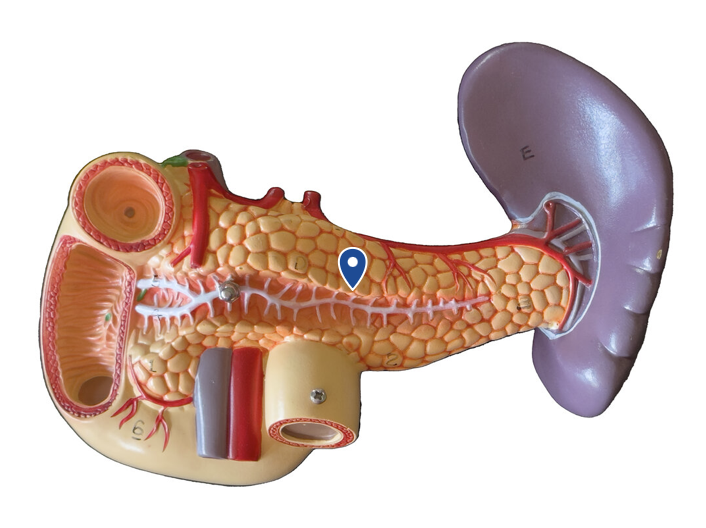 <p>Name this organ.</p>
