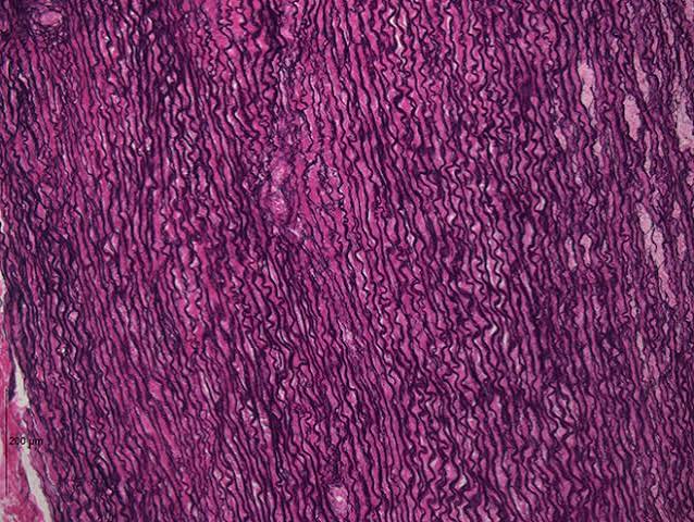 <p>fxn: allows tissue to recoil after stretching, found in large arteries</p>