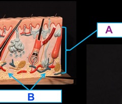 <p>B</p>