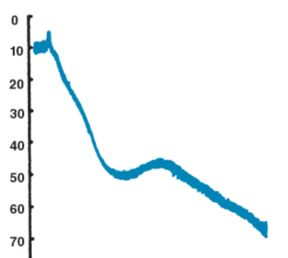 <p>A <strong><u>biphasic</u></strong> aggregation trace pattern is produced by which agonist?</p>