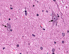 <p>How would you describe the nucleous of the indicated cells compared to others?</p>