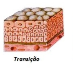 <p>transição (bexiga)</p>