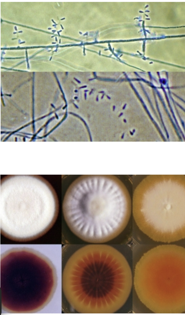 <p>-Skin and nail infections (most common worldwide)</p><p>-Colony surface is white/buff</p><p>-Colony bottom is red</p><p>-Tear shaped microconidia (“birds on a wire”)</p><p>-Negative for hair shaft penetration</p><p>-Dermatophyte</p>
