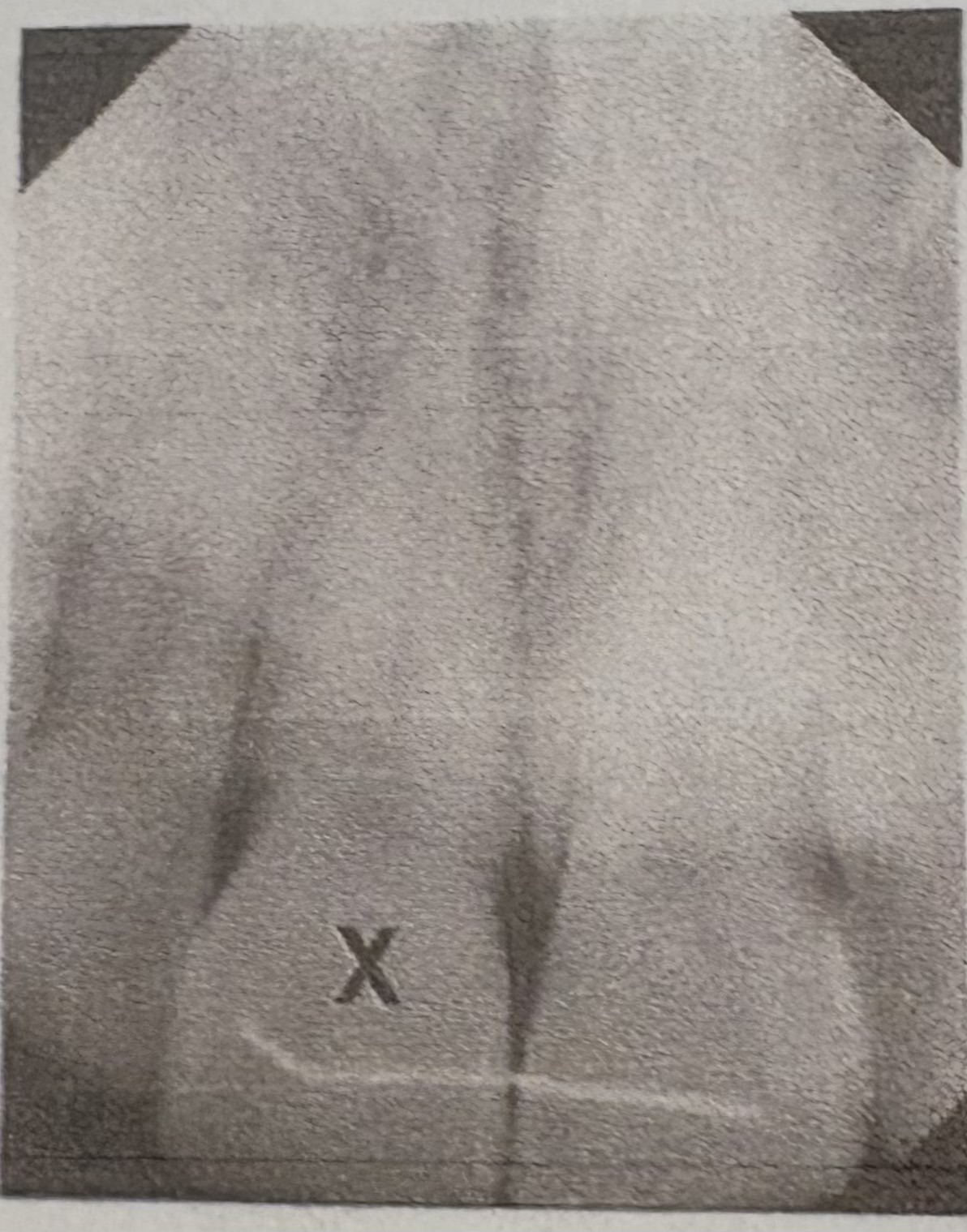 <p>Identify (#) tooth shown on x-ray:</p>