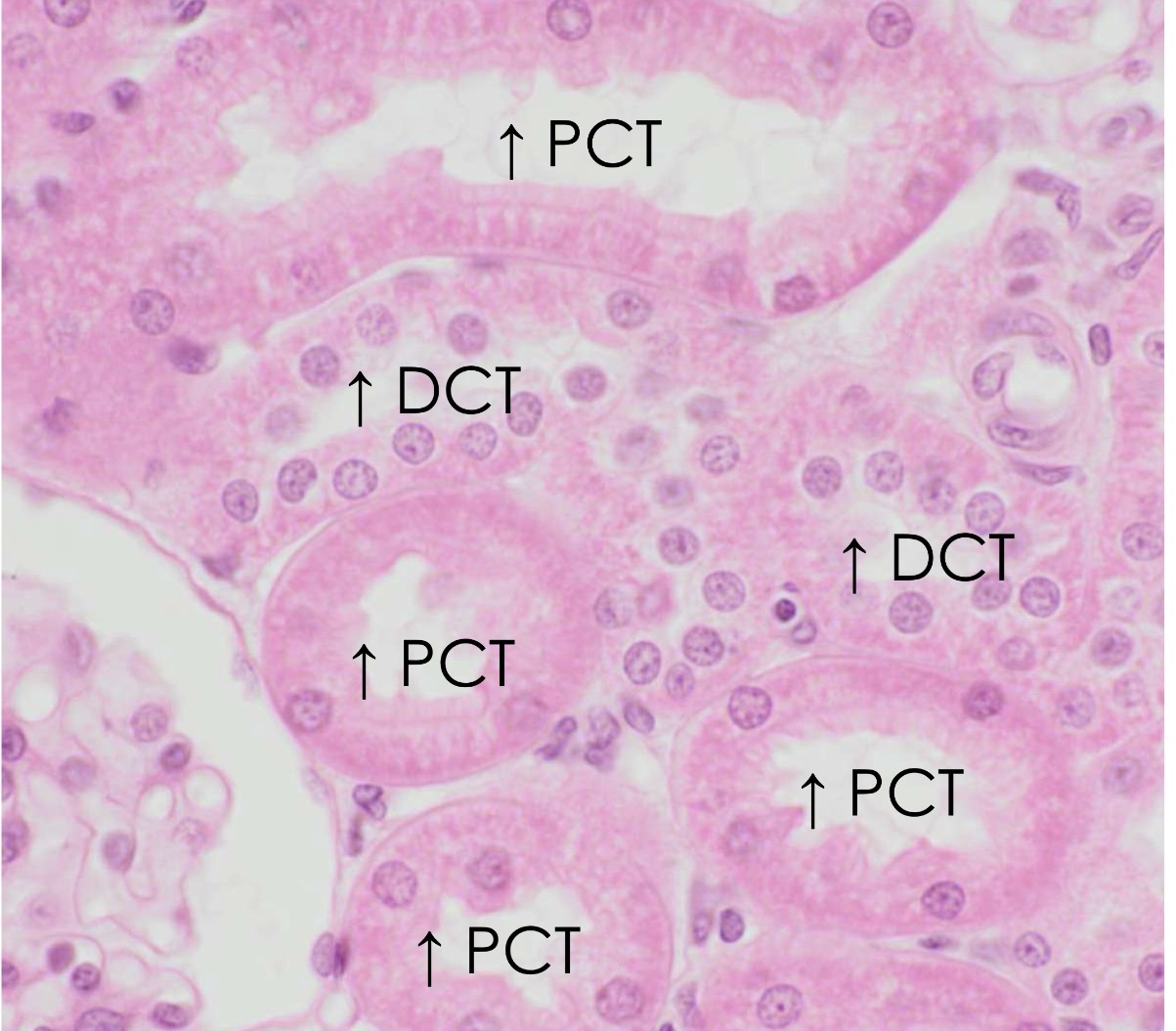 <p>DCT</p>