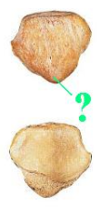 <p><span>Identify the indicated bone marking (projection)?</span></p>