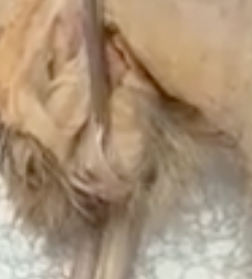 <p>what part of the penis is the prong touching</p>