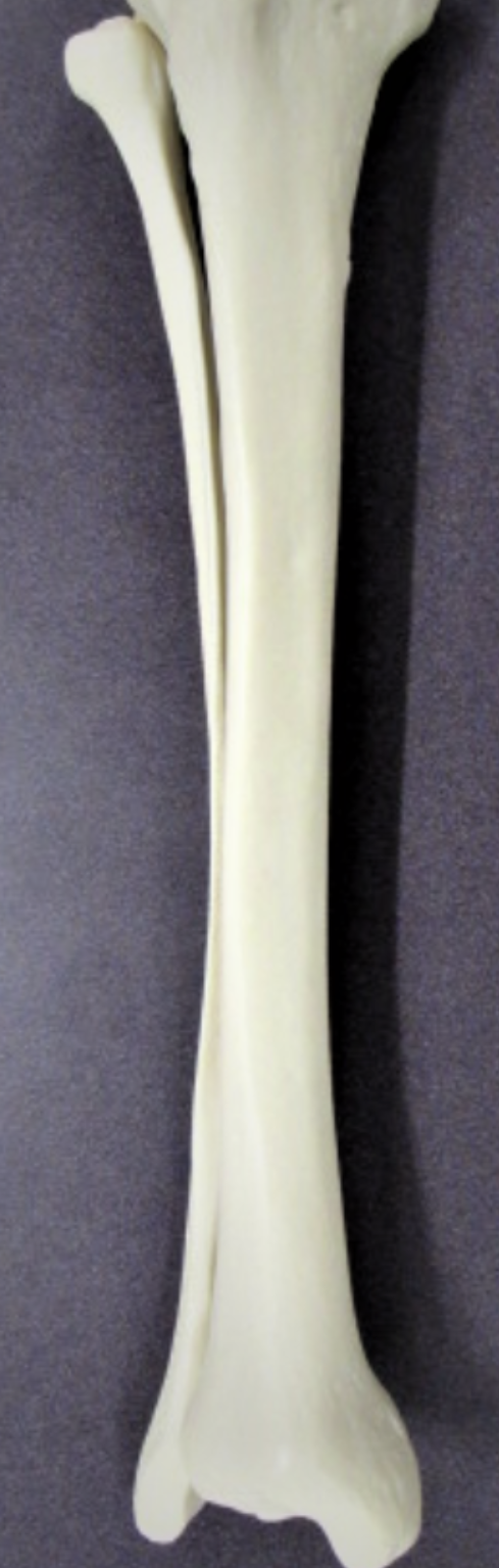 <p><span><strong>These bones came from the ________ side of the body.</strong></span></p>
