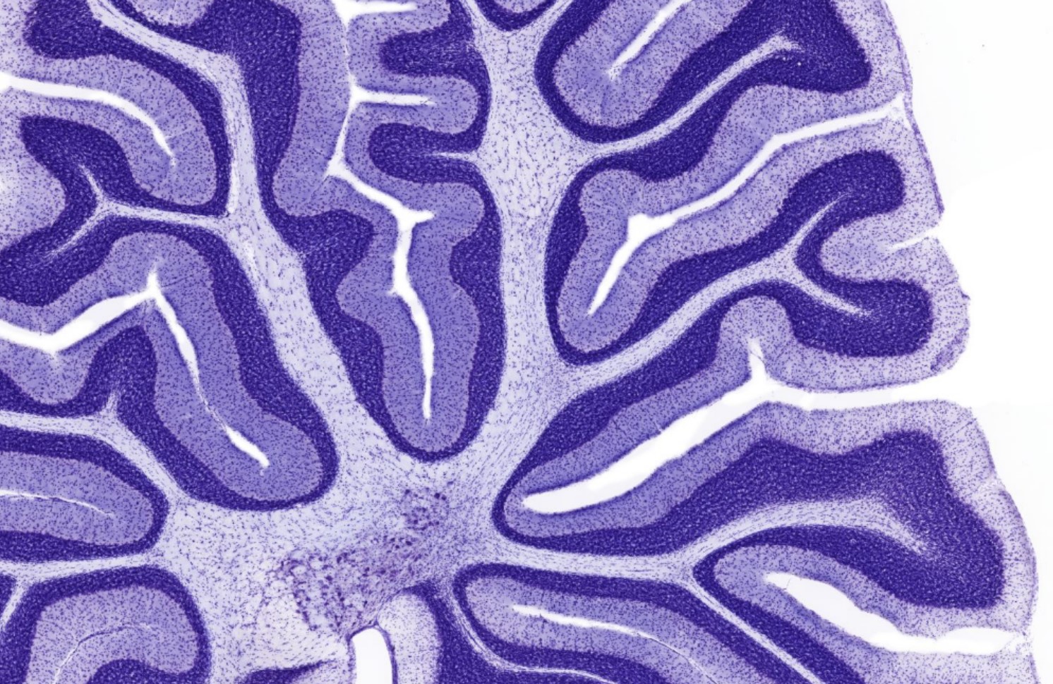 <p>Identifica la plaquita</p>