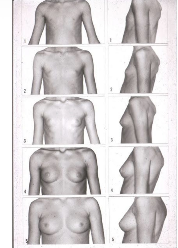 <p>Ma5</p>