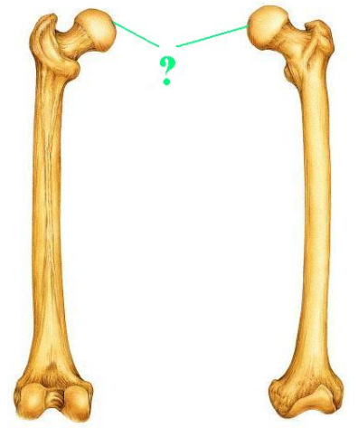 <p><span>Identify the indicated bone marking (depression)?</span></p>