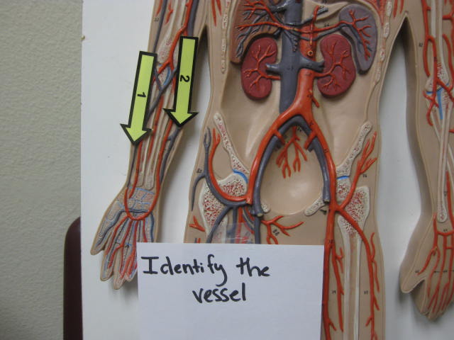 <p>Identify The Vessel 1 and 2?</p><p>Lab Image 3-15</p>