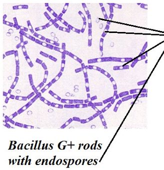 <p>Bacillus: Gram-positive (purple) rods in chains, with endospores.</p>
