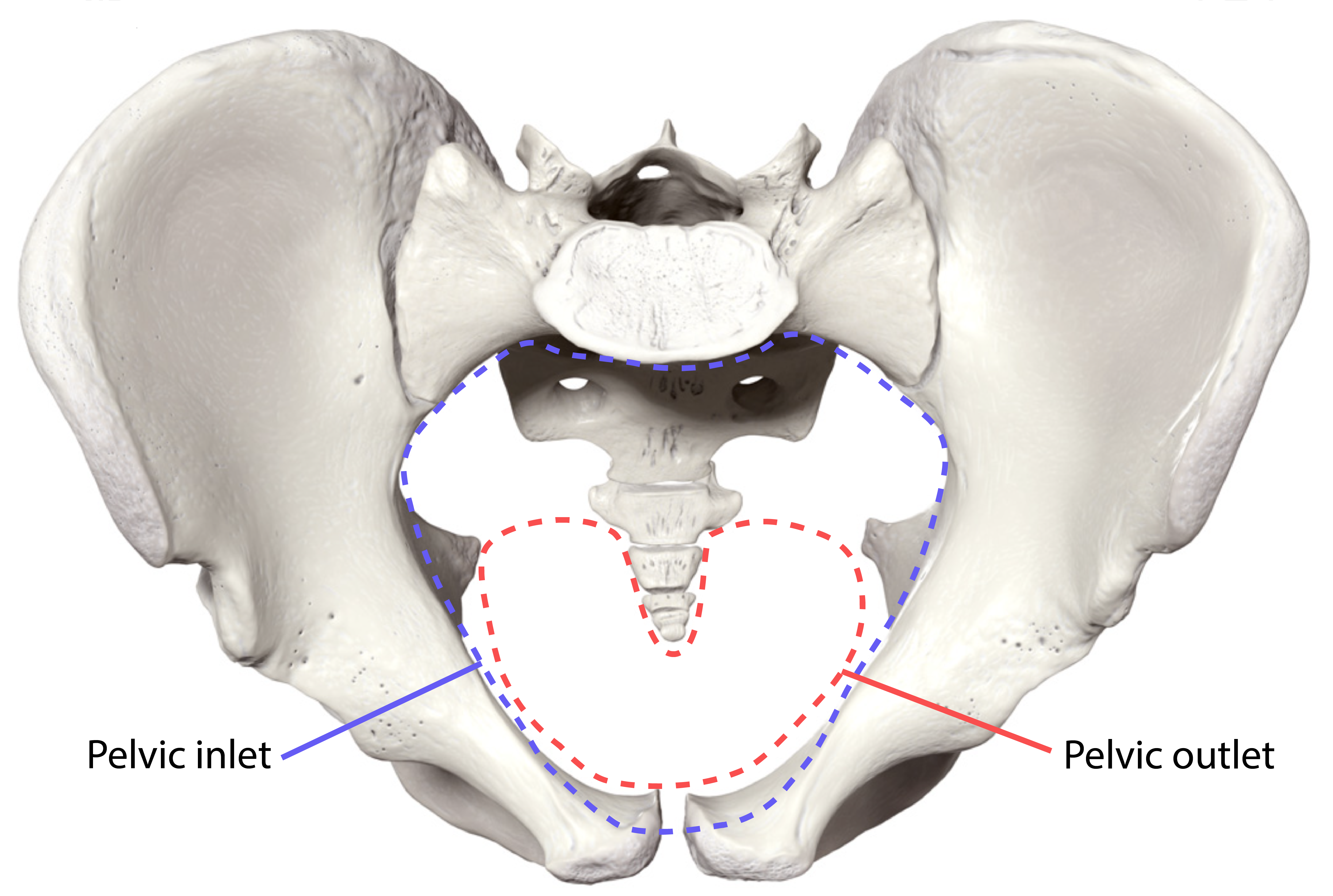 <p>inferior to the pelvic inlet, boundaries are defined by the coccyx, ischial tuberosities, and the inferior border of the pubic symphysis </p>