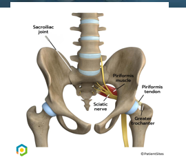 <ul><li><p><span style="font-family: "Century Gothic";">Joint of the pelvic girdle</span></p></li><li><p><span style="font-family: "Century Gothic";">Between auricular surface of the</span><span style="font-family: "Century Gothic"; color: red;"> <strong>sacrum and ilium</strong></span></p></li><li><p><span style="font-family: "Century Gothic";">Strong, weight bearing joints</span></p></li><li><p><span style="color: red;"><strong>Anterior synovial joint-</strong></span>, covered with articular cartilage</p></li><li><p><span style="font-family: "Century Gothic";">Transfers weight from spine to the pelvis to the lower limbs</span></p></li><li><p><span style="font-family: "Century Gothic";">Provides stability</span></p></li><li><p><span style="font-family: "Century Gothic";">Very </span><span style="color: red;"><strong>limited mobility</strong></span></p><ul><li><p><span style="color: red;"><strong>Slight gliding and rotary movement</strong></span></p></li><li><p><span style="font-family: "Century Gothic";">Due to interlocking of articulating bones and ligaments </span></p></li></ul><p></p></li><li><p><span style="font-family: "Century Gothic";"><strong>Clinical correlation</strong></span></p><ul><li><p><span style="font-family: "Century Gothic";">SI joint dysfunction</span></p></li><li><p><span style="font-family: "Century Gothic";">Sacroilitis </span></p></li></ul></li></ul><p></p>