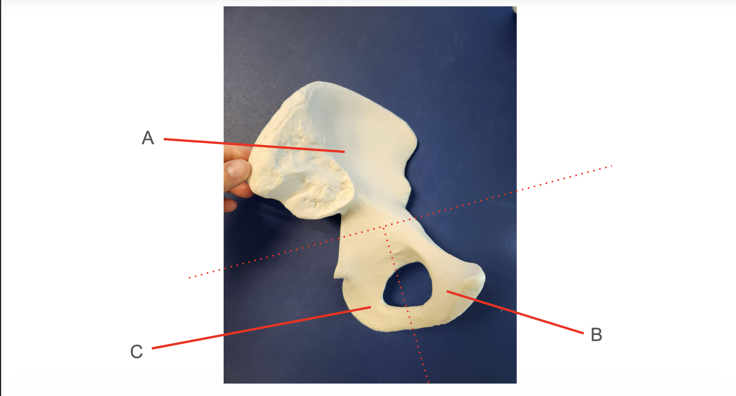 <p>Identify Structure B</p>