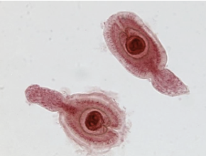 <p>What metacestode stage is this?</p>