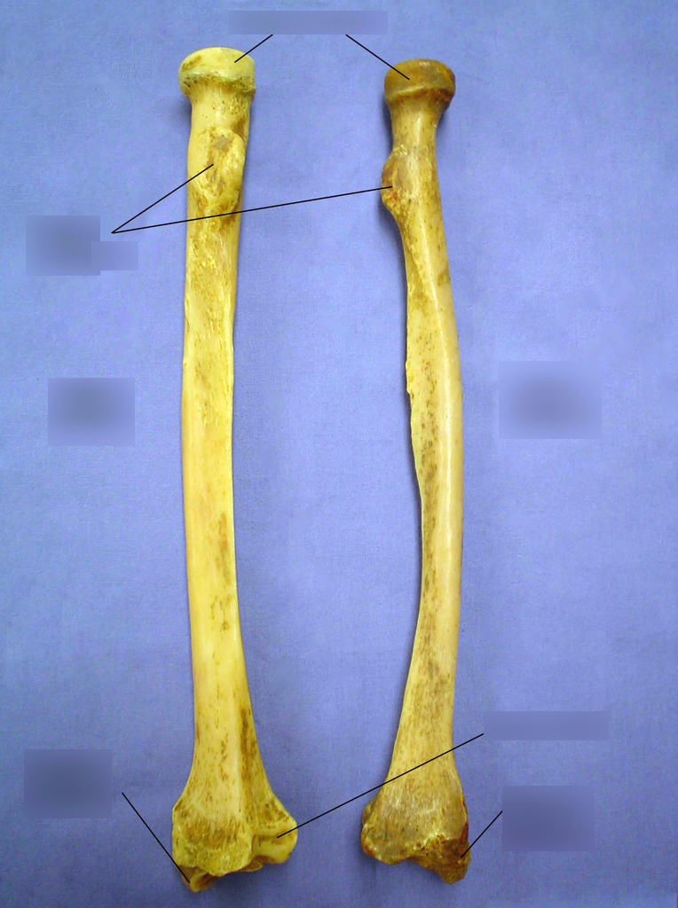 <p>Which one is left and right and what bone </p>