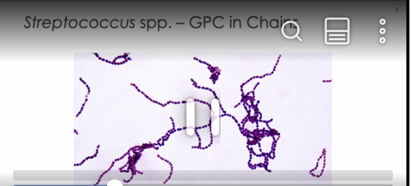 <p>Gram+ cocci in chains</p><p>Catalase negative</p>