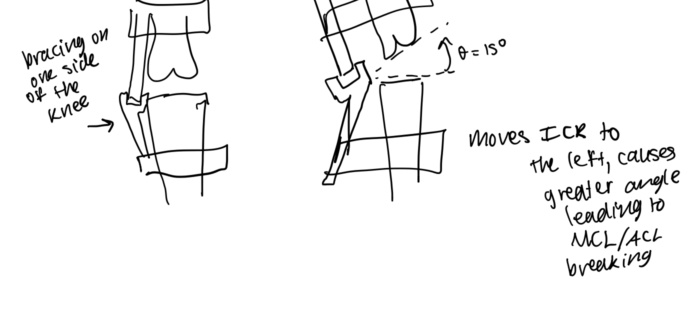 <p>If one sided support, extends the ICR to the left of the knee. If receiving impact force from other direction, can cause more severe injury leading to MCL/ACL breaking. If force leads to same angular displacement with and without brace, if ICR is to the left, will cause significantly more vertical displacement in knee than if ICR is at the center of the knee. Need to provide bracing on both sides in order to maintain central ICR.</p>